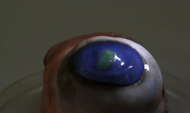 Is This Why The Antichrist and Beast Will Scan The Forehead—666 Underway!