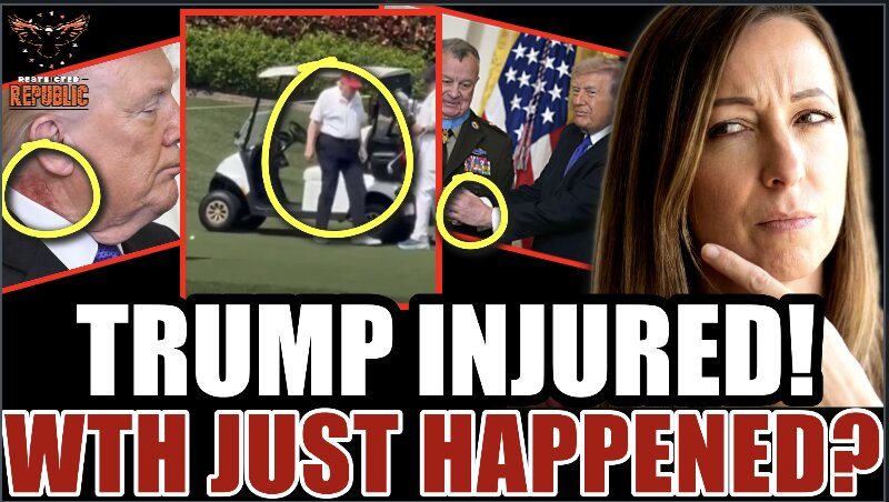 Trump Injured! WTH Just Happened? White House Forced to Respond! 