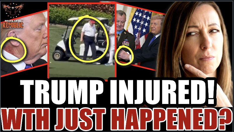 Trump Injured! WTH Just Happened? White House Forced to Respond! 